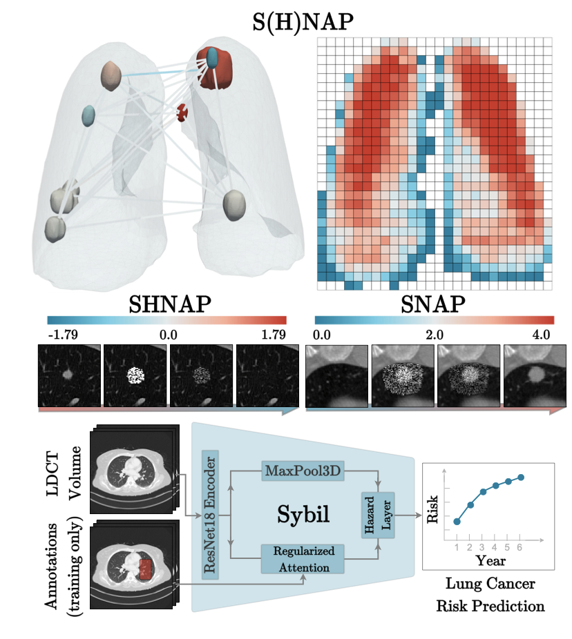 S(H)NAP lung cancer risk prediction research